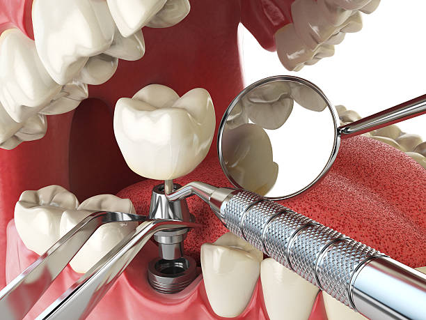 Best Cracked Tooth Emergency Dentist  in Leland Grove, IL